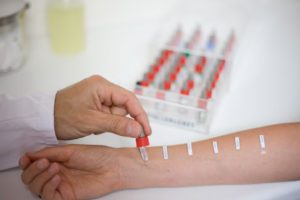 allergy-na-mjatu3-300x200-6514419