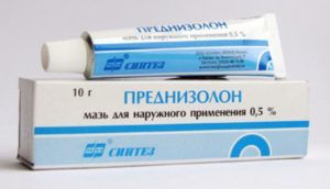 allergiya_na_nikel4-300x172-4973450