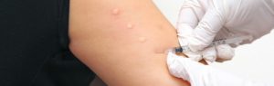 analiz-na-allergy-u-rebenka2-300x95-4333196