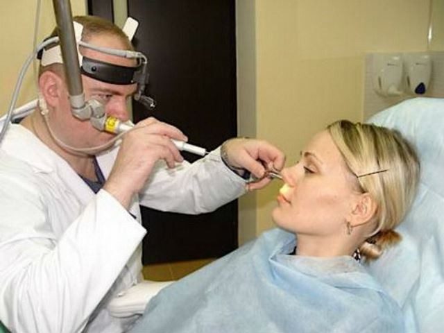 laser-of-sinusitis-7861368