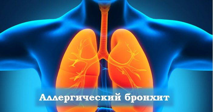 lechenie-narodnymi-sredstvami-2-1452651