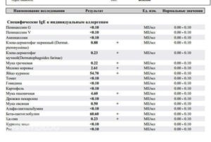 analiz-krovi-na-allergy2-300x202-5896643
